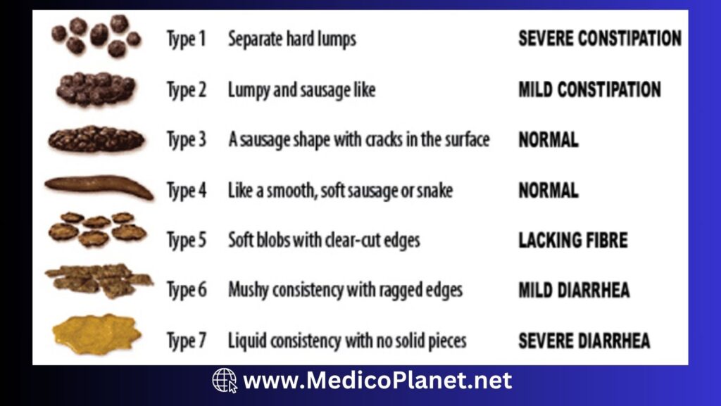 bristol stool chart